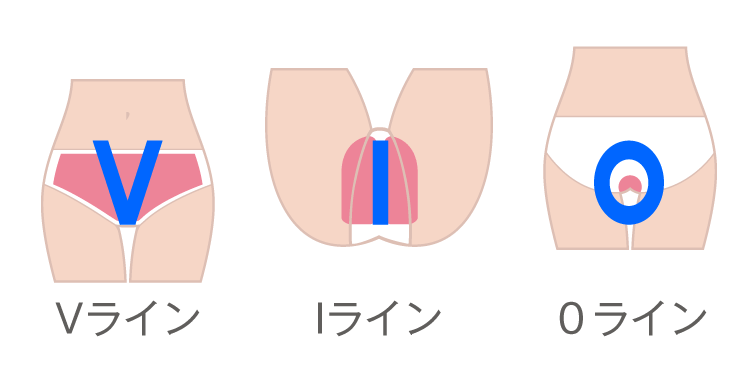 Vio脱毛でデリケートゾーンも清潔 Vio脱毛専門サロン プリート